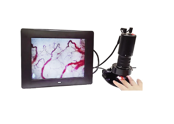 微循環(huán)血液檢測儀特點與應用是哪些